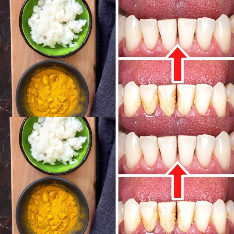 Naturalne Czyszczenie Zębów: Jak Usunąć Kamień Nazębny Bez Dentysty z Kurkumą i Solą