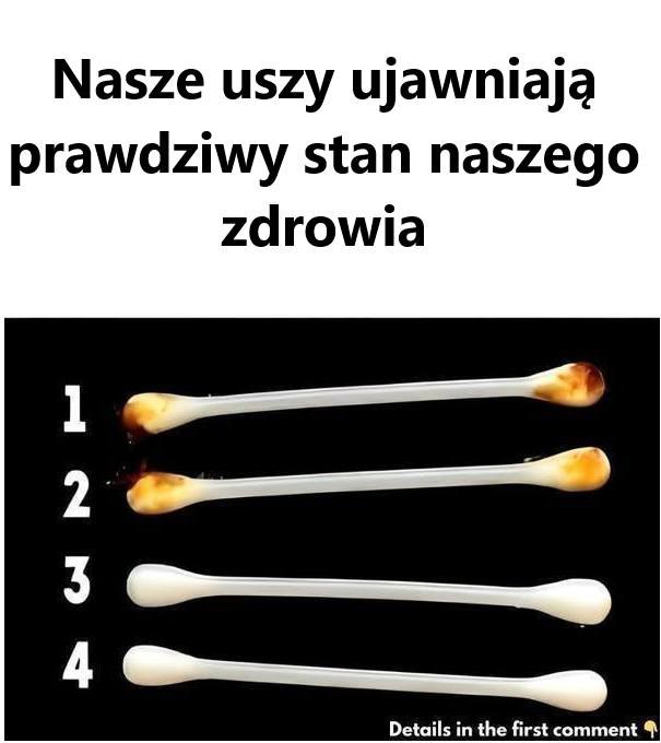 Co Uszy Mówią o Twoim Zdrowiu? Zaskakujące Fakty i Wskazówki