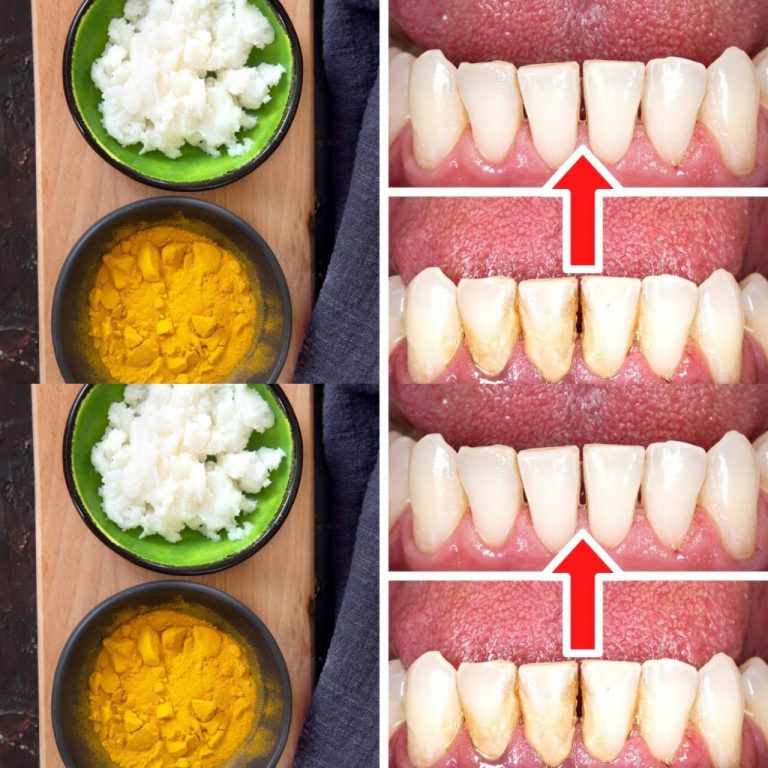 Naturalne Czyszczenie Zębów: Jak Usunąć Kamień Nazębny Bez Dentysty z Kurkumą i Solą