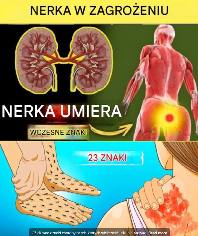 23 nietypowe objawy chorej nerki, które łatwo przeoczyć – sprawdź, zanim będzie za późno