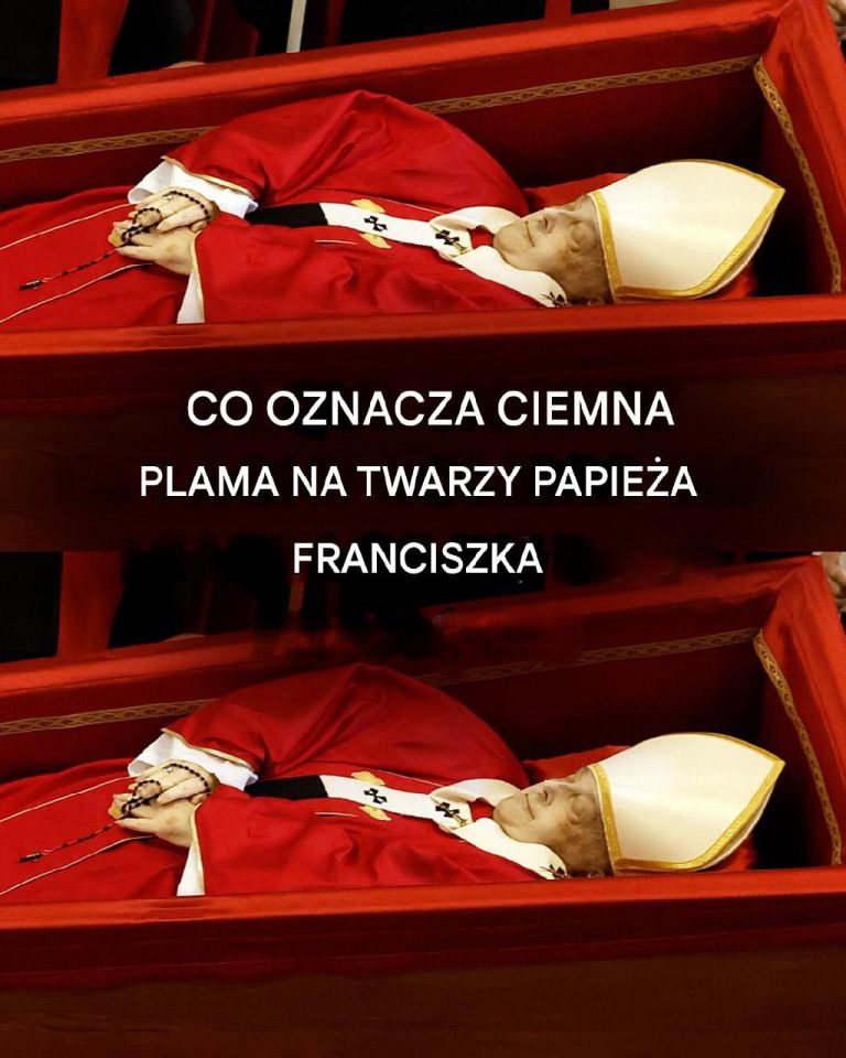 Co to za ciemna plama widoczna na twarzy papieża Franciszka: hipotezy ekspertów