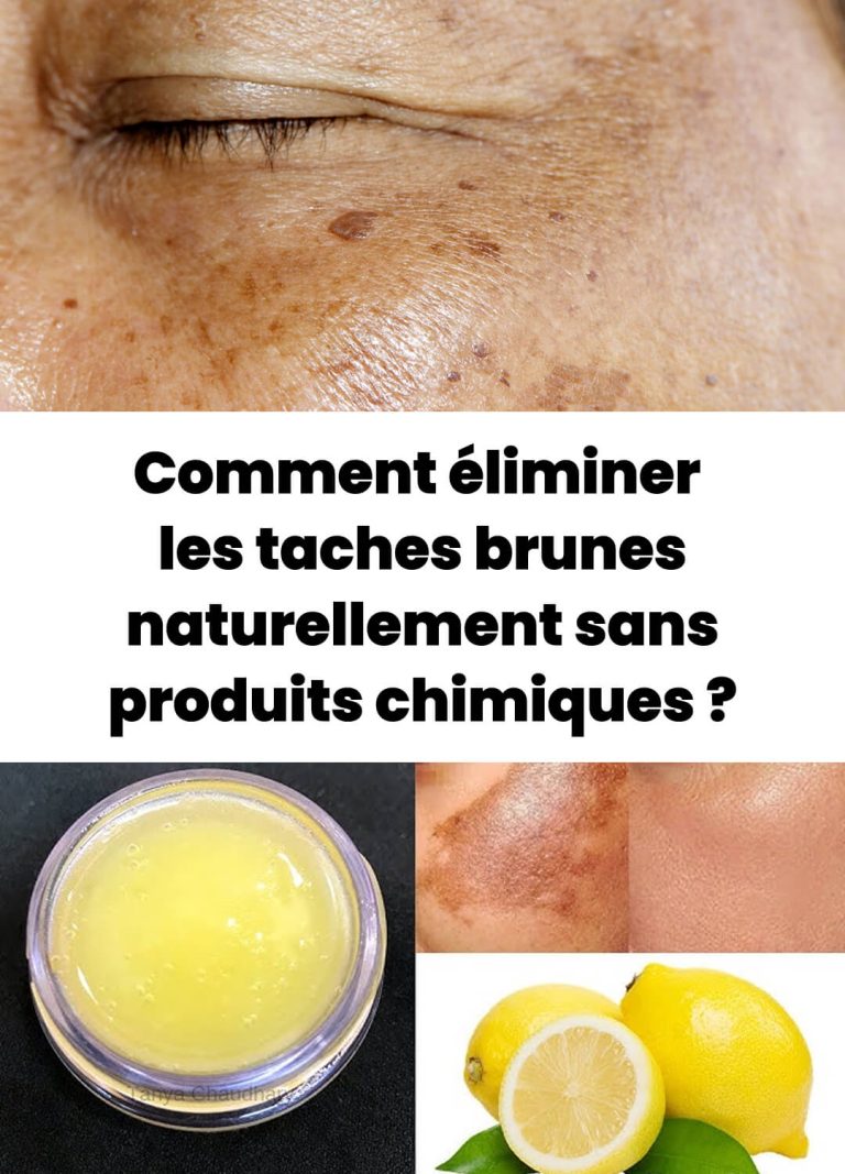Comment se débarrasser des taches brunes avec des solutions naturelles ?