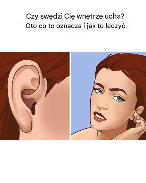 Moje swędzą cały czas! Musiałam to zobaczyć!
