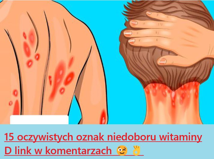 15 oczywistych oznak niedoboru witaminy D