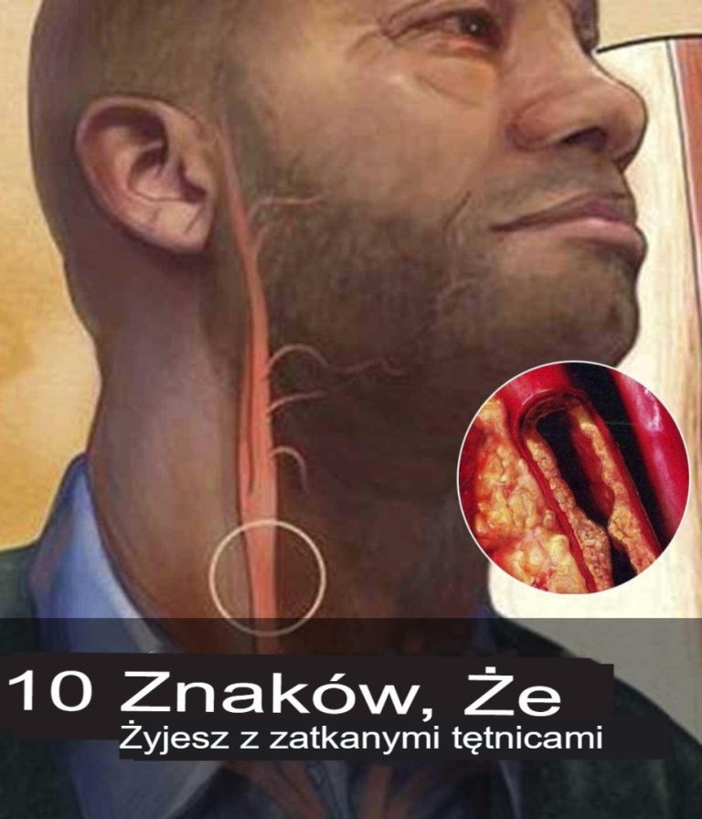 10 oznak, że żyjesz z zatkanymi tętnicami