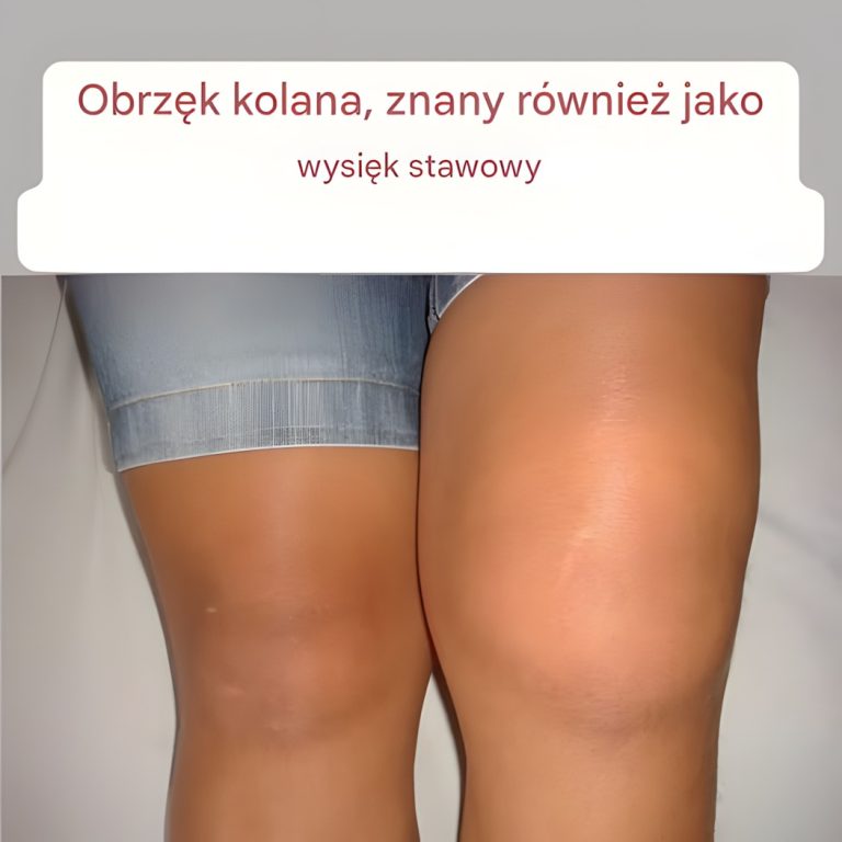 7 alarmujących oznak, że spożywasz za dużo soli