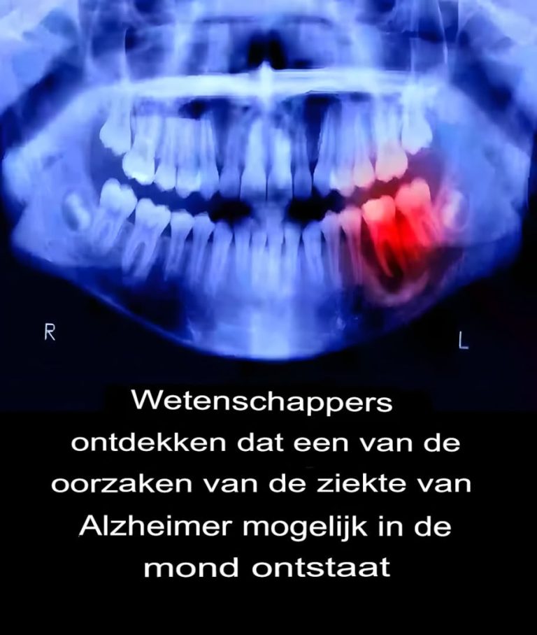 Naukowcy odkryli, że jedną z przyczyn choroby Alzheimera może być jama ustna