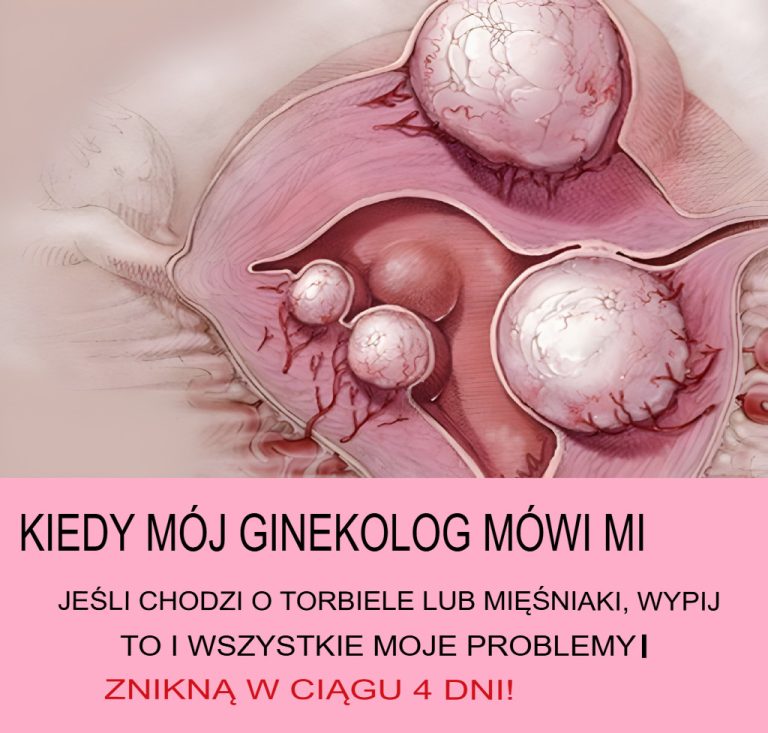Jeżeli mój ginekolog stwierdzi, że mam torbiel lub guz w macicy, wypiję ten napój, a wszystkie moje problemy znikną w ciągu 4 dni!