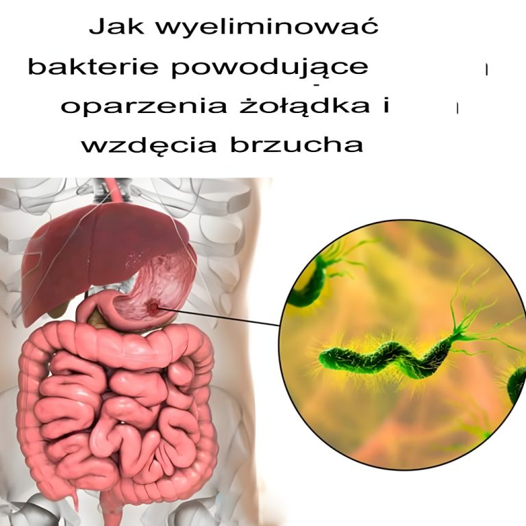 Jak wyeliminować bakterie powodujące zgagę i wzdęcia