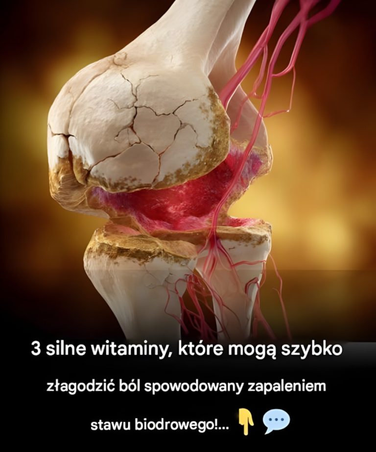 3 najlepsze witaminy na zapalenie stawów biodrowych – pożegnaj się z bólem bioder