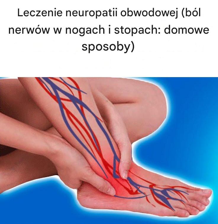 Leczenie neuropatii obwodowej [Ból nerwów w nogach i stopach: domowe sposoby]